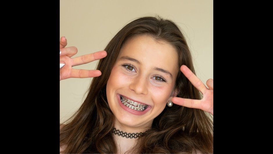 Хочу брекеты а зубы ровные