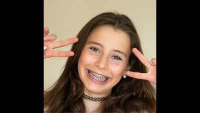 Девушки с брекетами