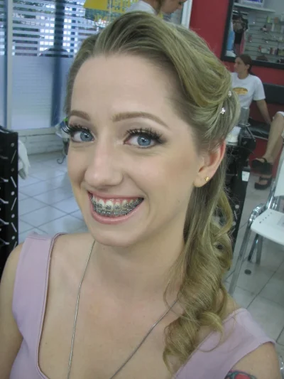 Керамические брекеты девушка