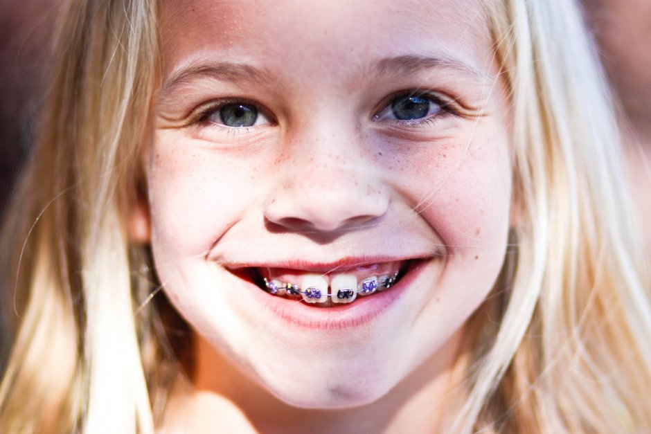 Блондинка с брекетами