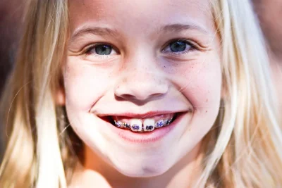 Блондинка с брекетами