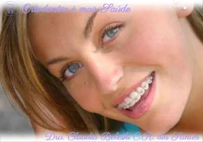 Брекеты керамические