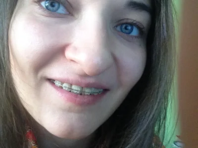 Девушка с сапфировыми брекетами