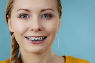 Девушка в прозрачных брекетах