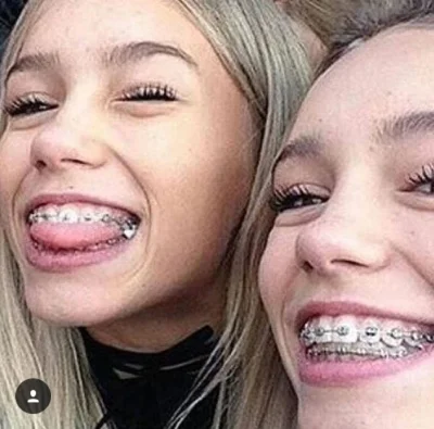 Девушка с брекетами селфи