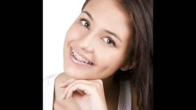 Смешные люди в брекетах