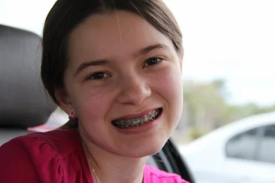 Брекеты с точки зрения йоги