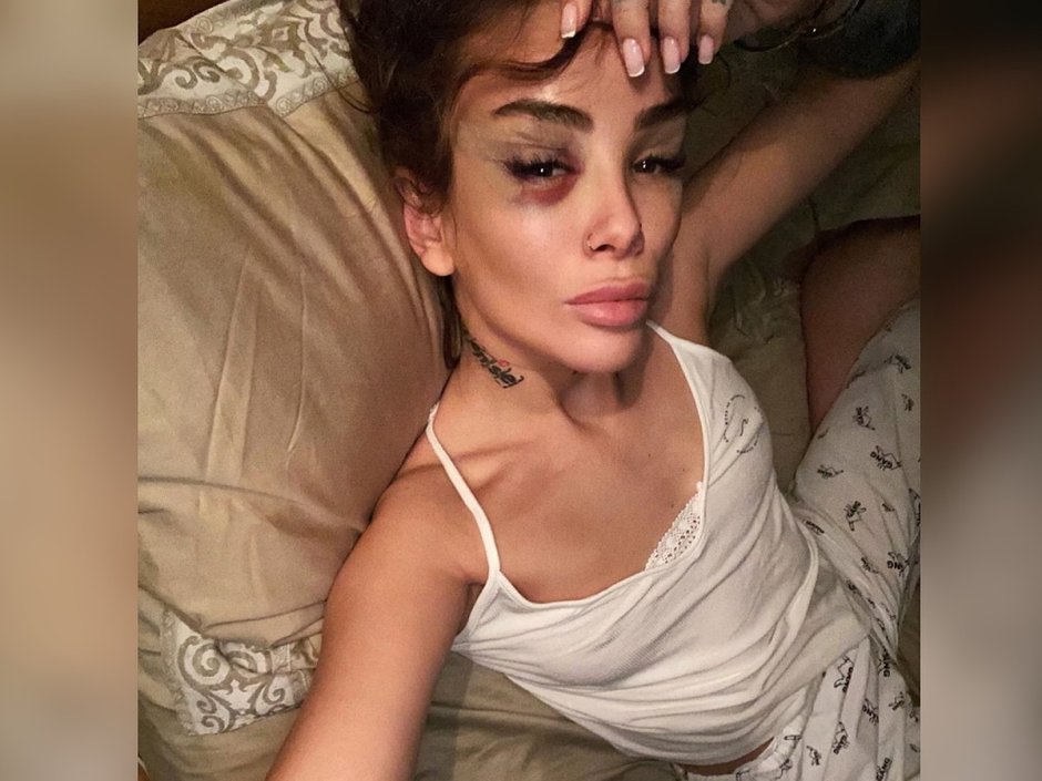 Айза Долматова