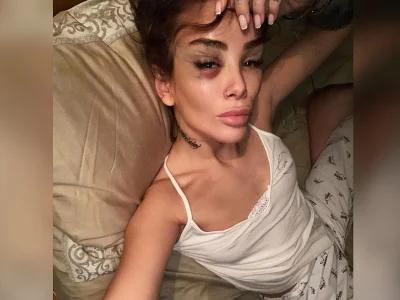 Айза Долматова