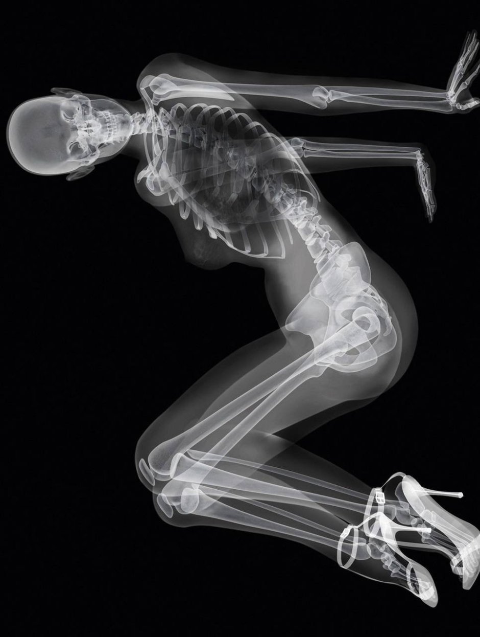 голая девушка рентген