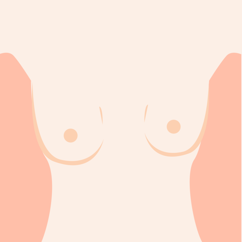 точки на груди у женщин фото 34