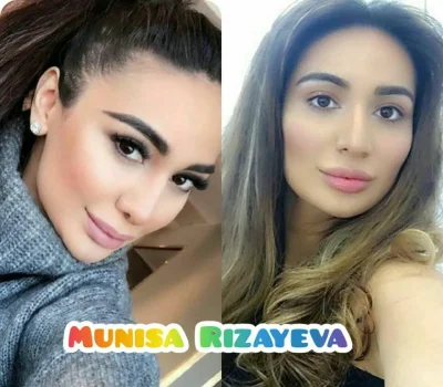 Муниса ризаева до и после пластики