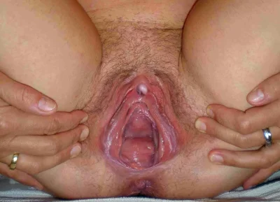 Влагалище беременных крупным планом