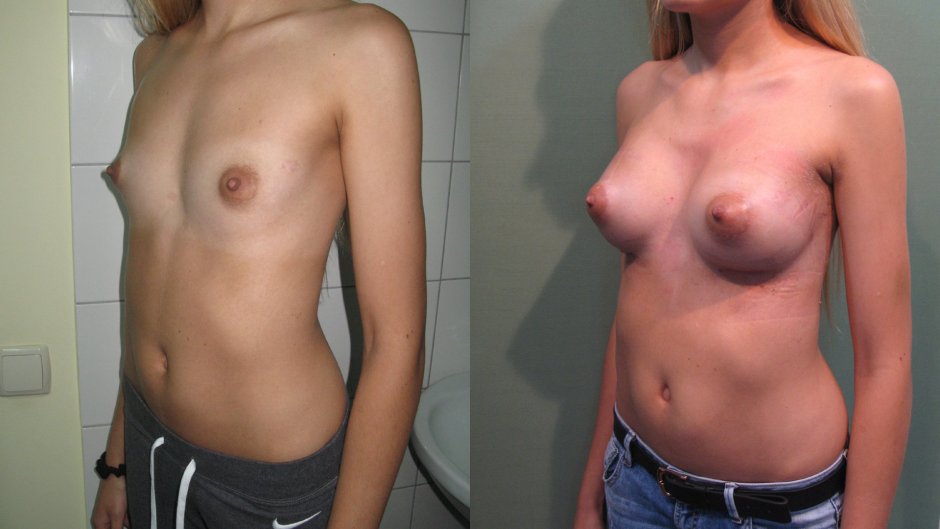 Женская грудь разного размера