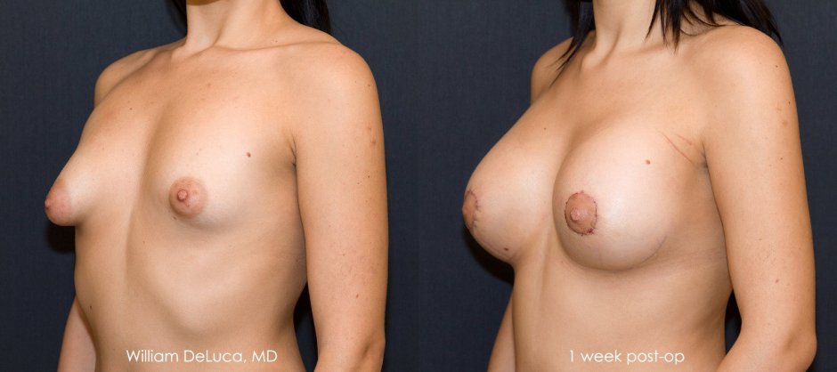 Женщине отрезали сиськи