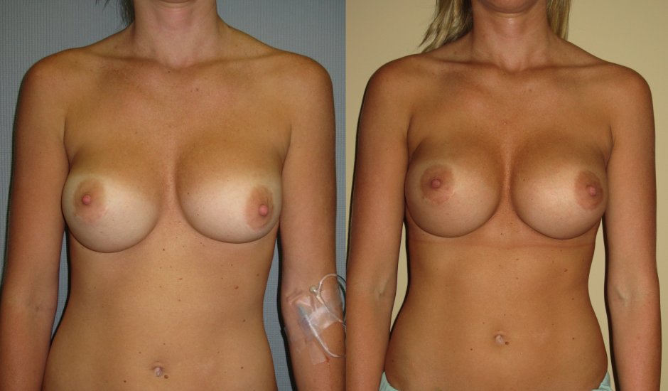 Голые сиськи после родов