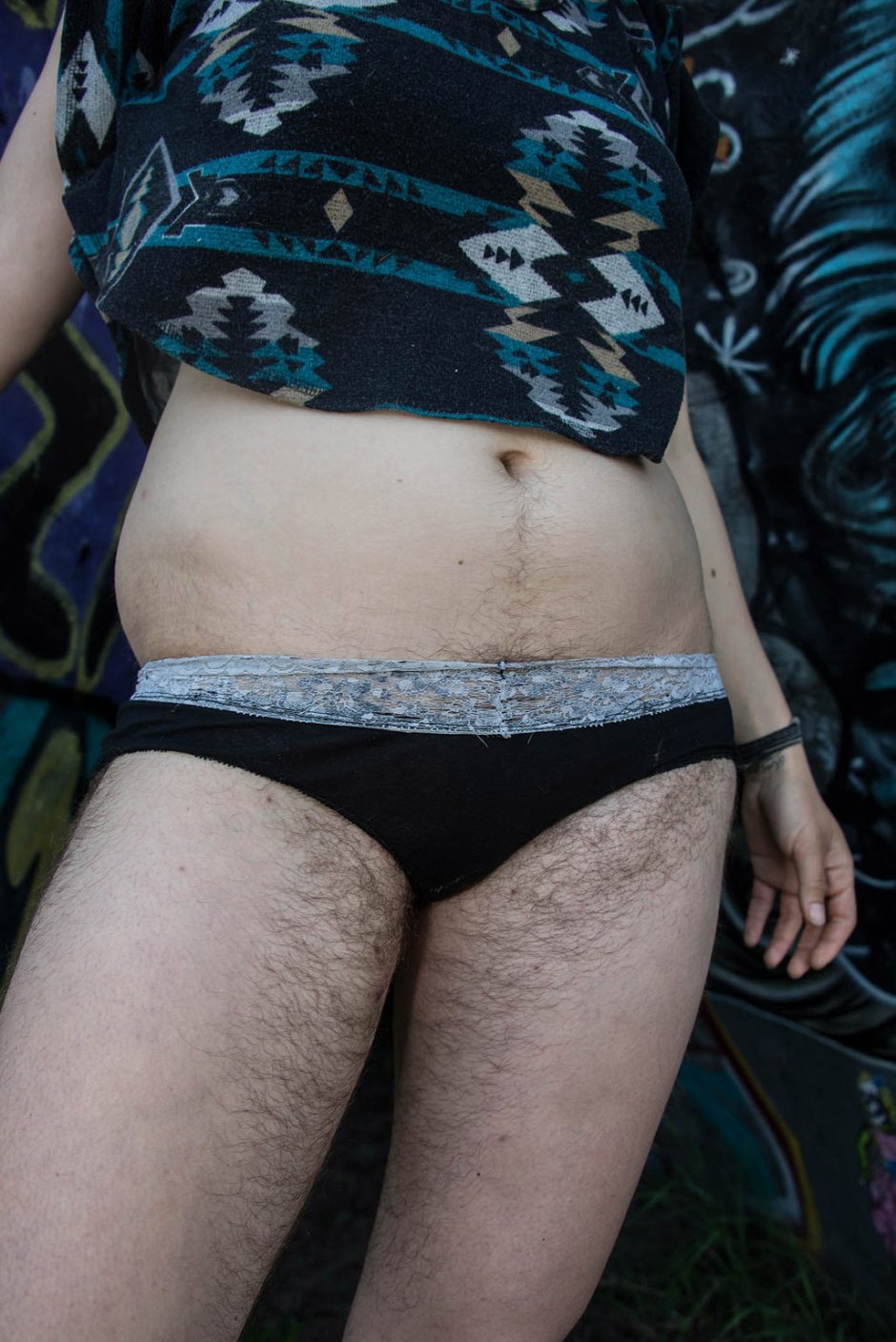 Волосатый живот у женщин