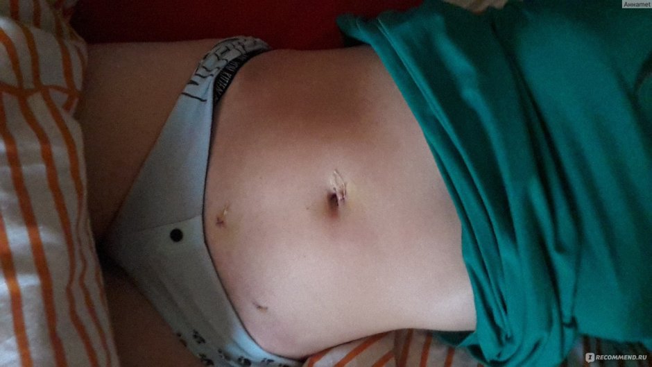 Выпуклый женский живот