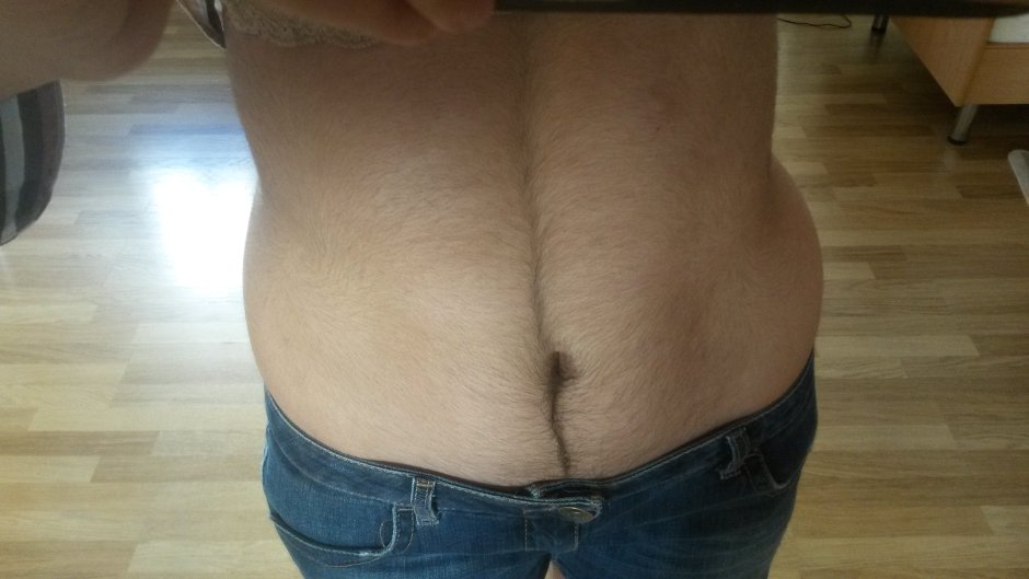 Волосы на животе у женщин