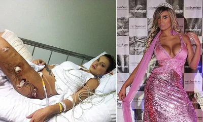 Андресса урах в больнице