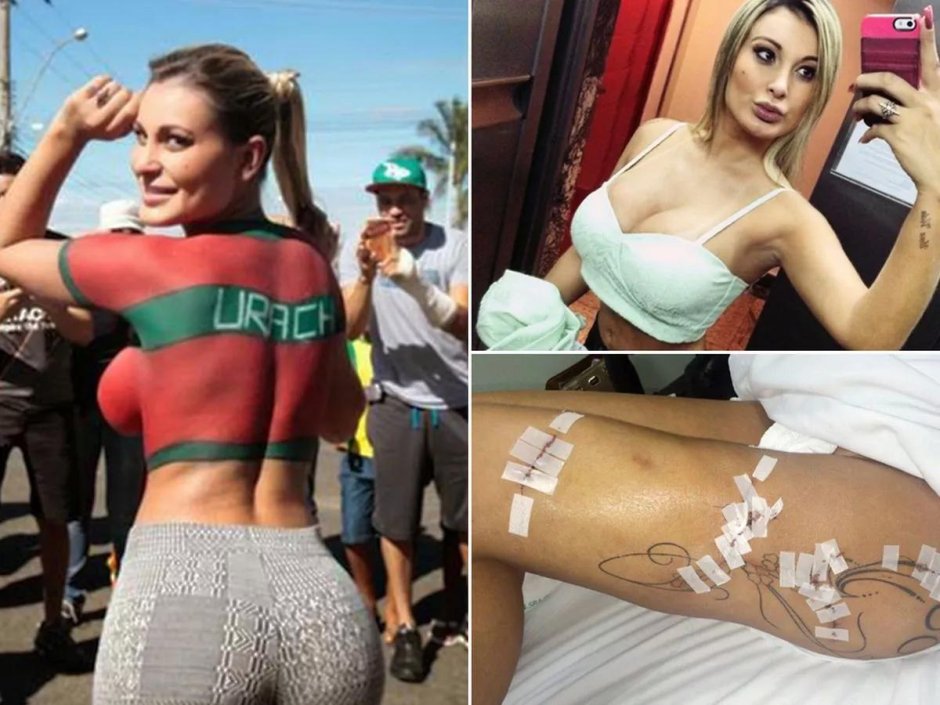 Андресса урак операция