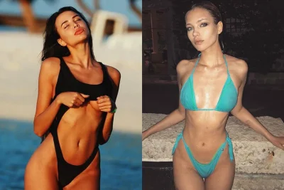 Анастасия решетова до пластики