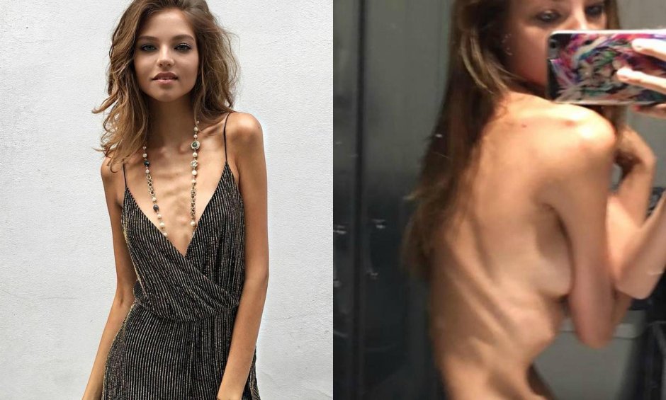 Алеся кафельникова худая