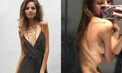 Алеся кафельникова худая