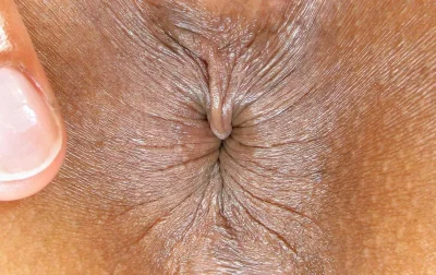 Глубокие морщины