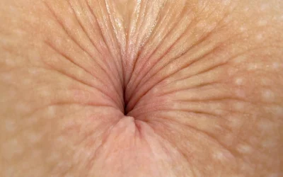 Анус крупный план