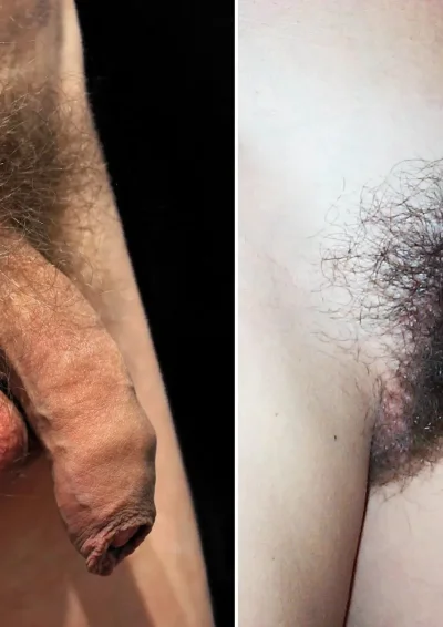 Лобковые волосы у мужчин