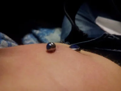 Прокол пупка