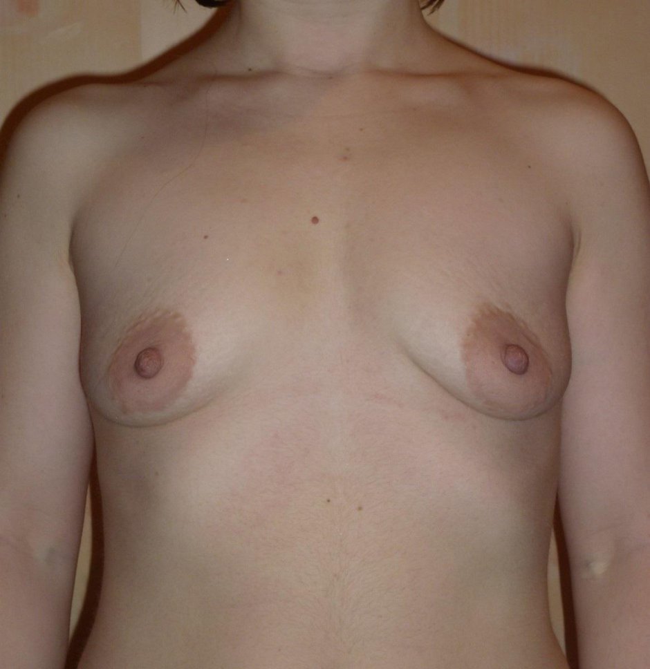 Маленькая женская грудь