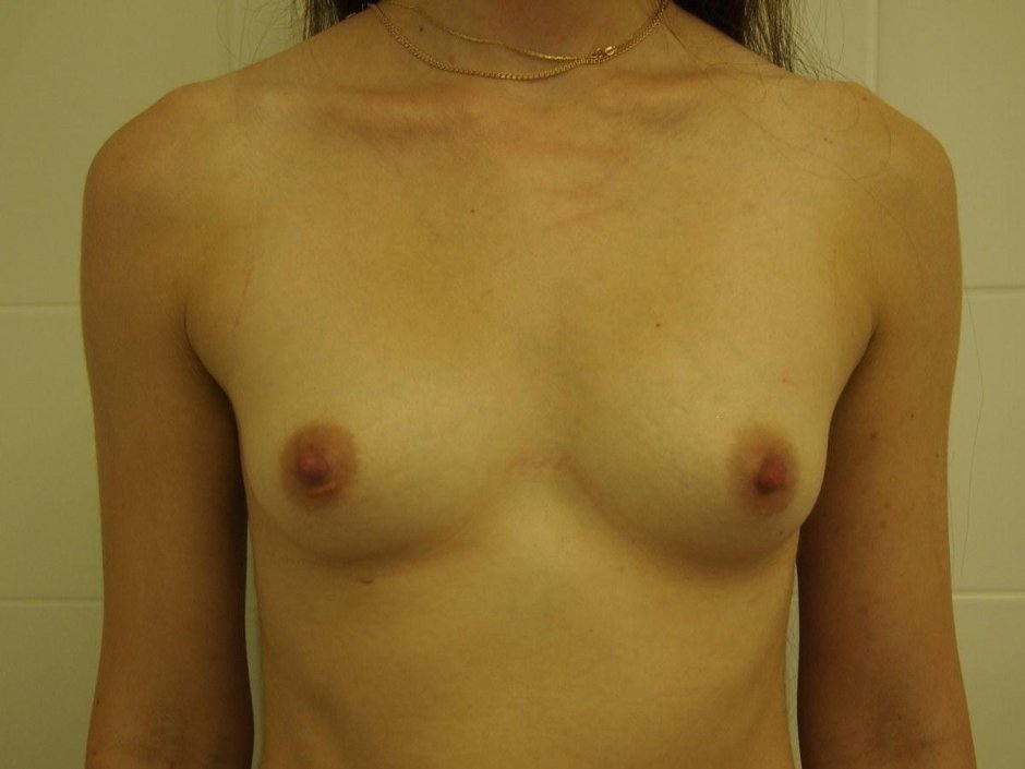 Для увеличения груди