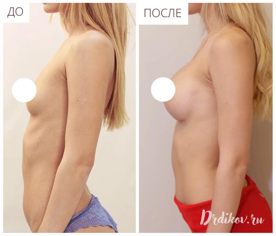 Для увеличения груди