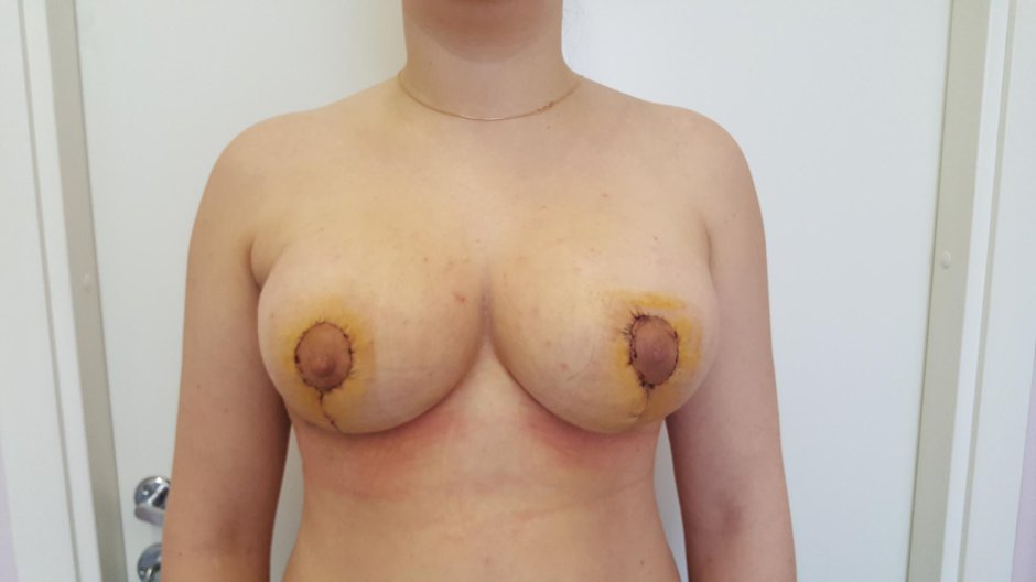 Разные формы сисек