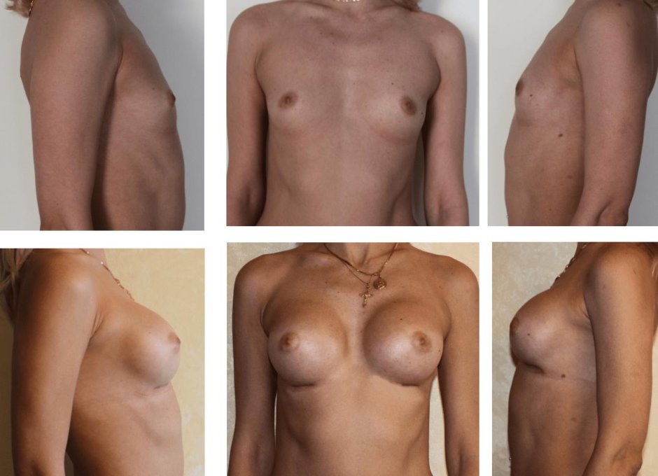 Необычная форма груди