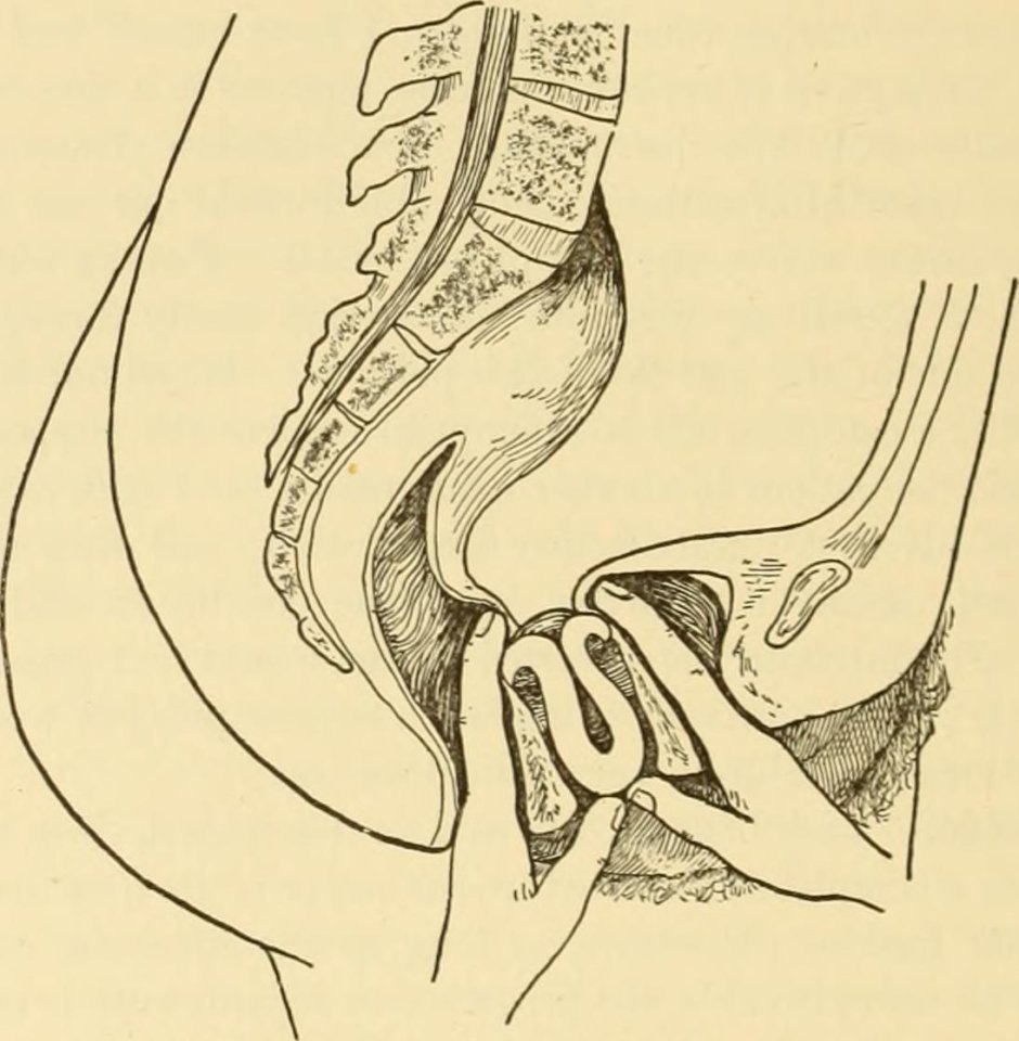Проникновение во влагалище