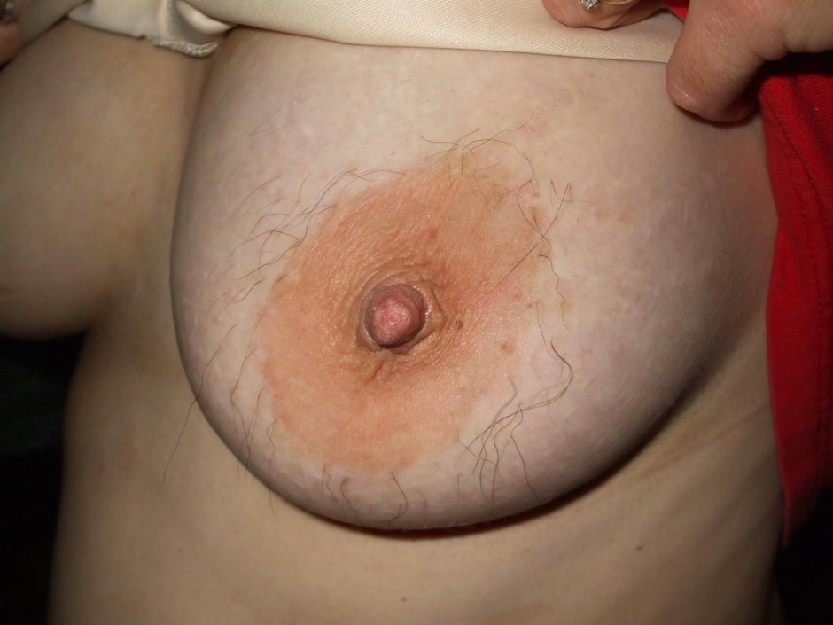 Пупки наружу