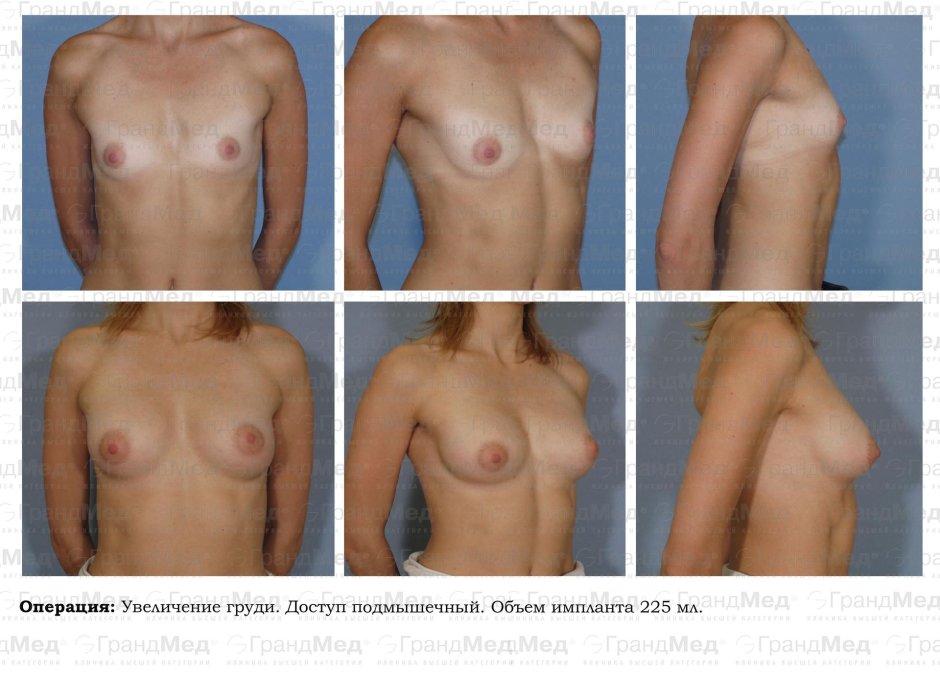 У девушки начали расти сиськи