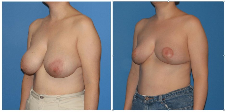 Идеальная сиська