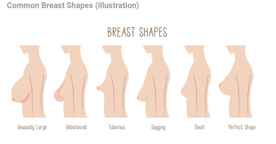 Breast shapes