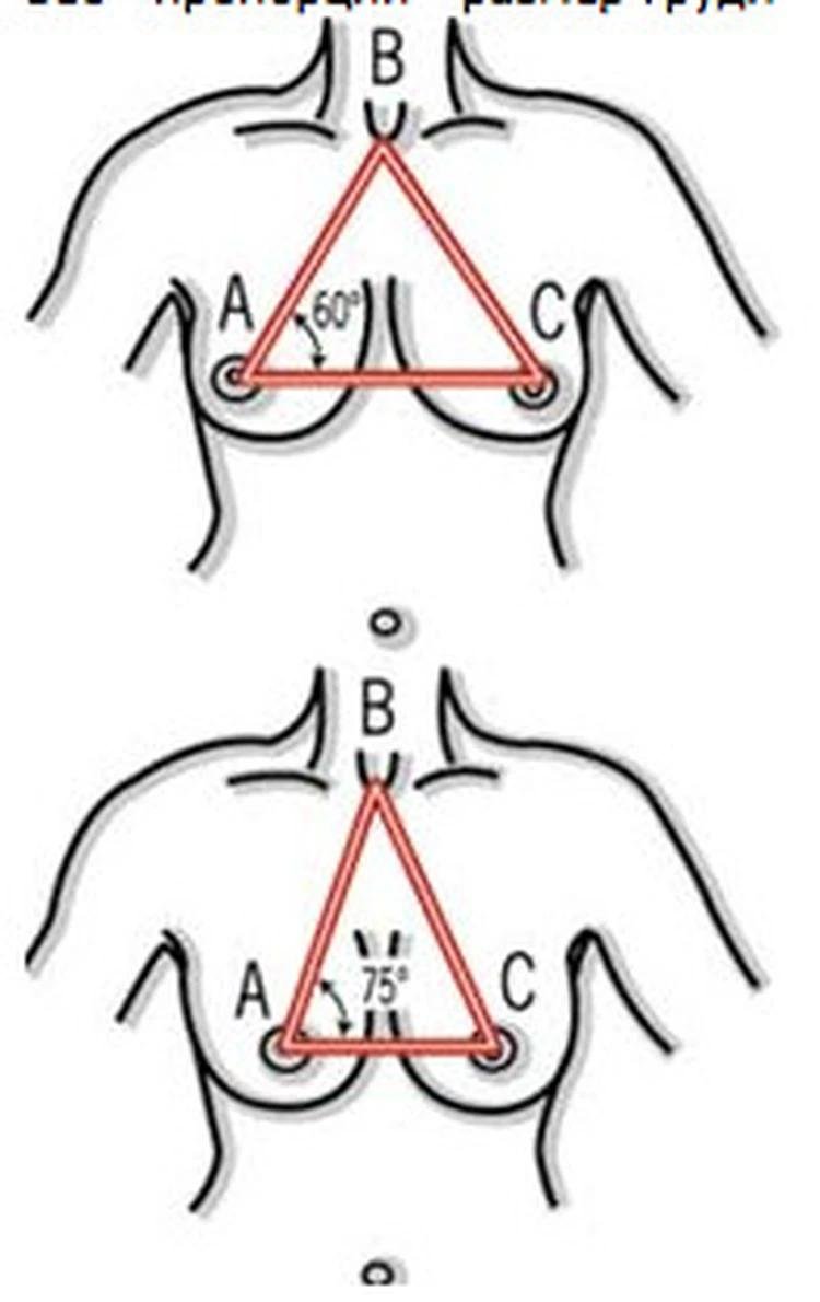 Грудь треугольной формы