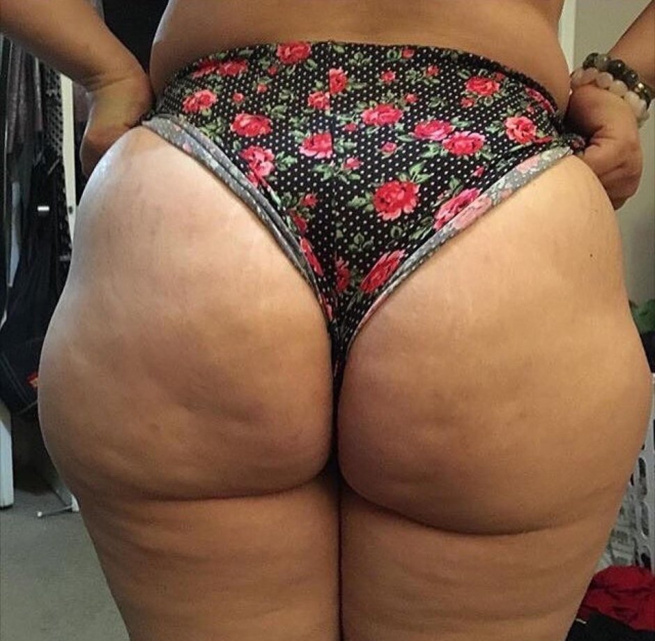 Толстые целлюлитные женщины