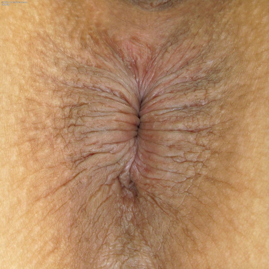 Женский анус крупным планом