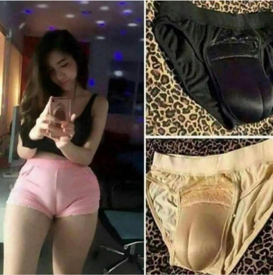 Верблюжье копыто у женщин