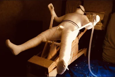 Человек полностью в гипсе