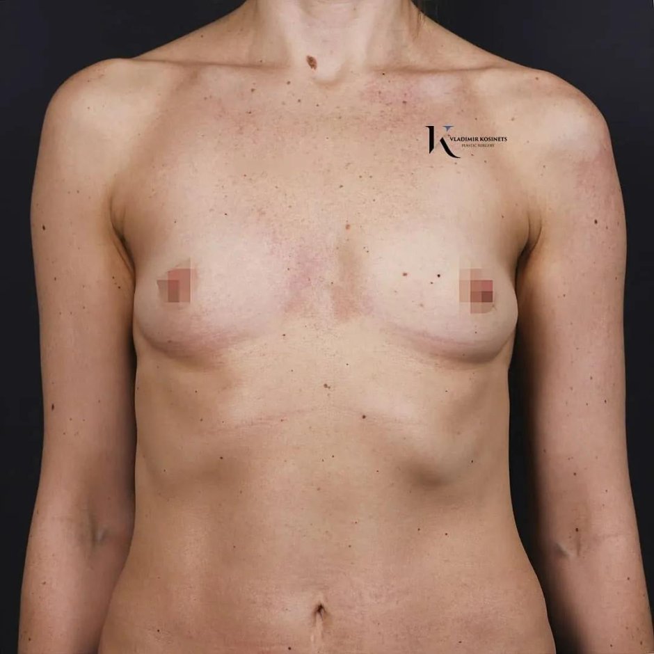 Грудь нулевка