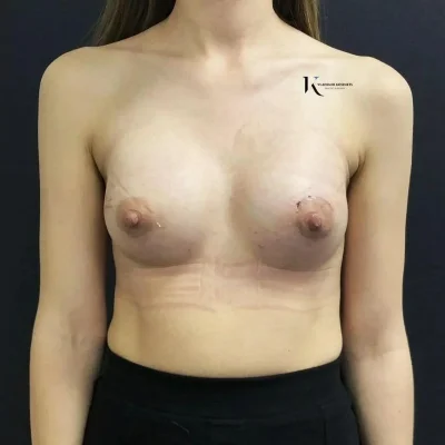 Естественная грудь