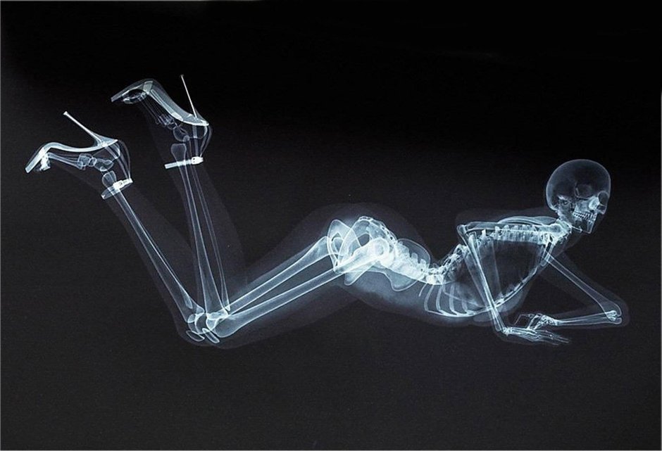 Рентгеновские лучи